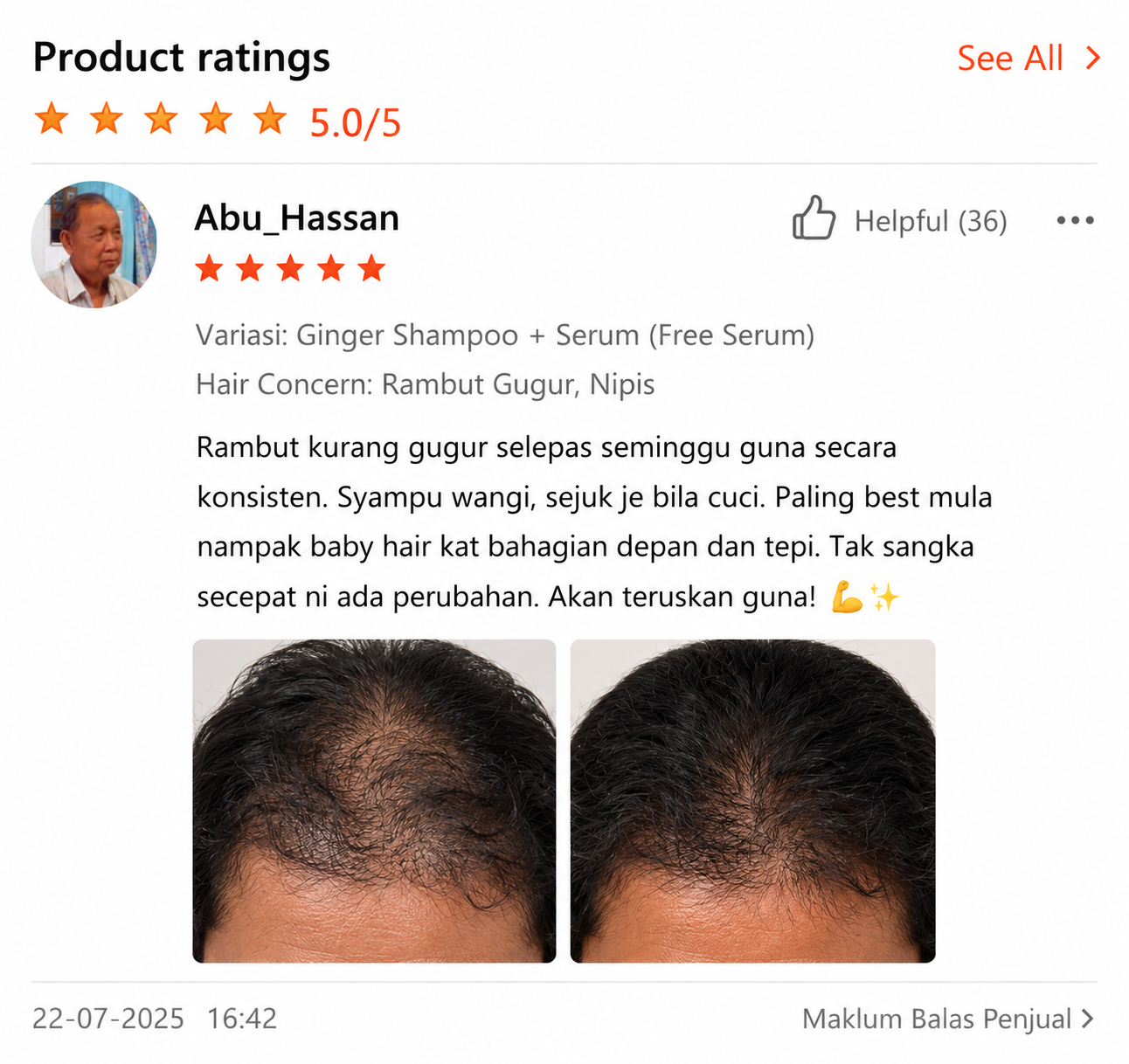 Review 2
