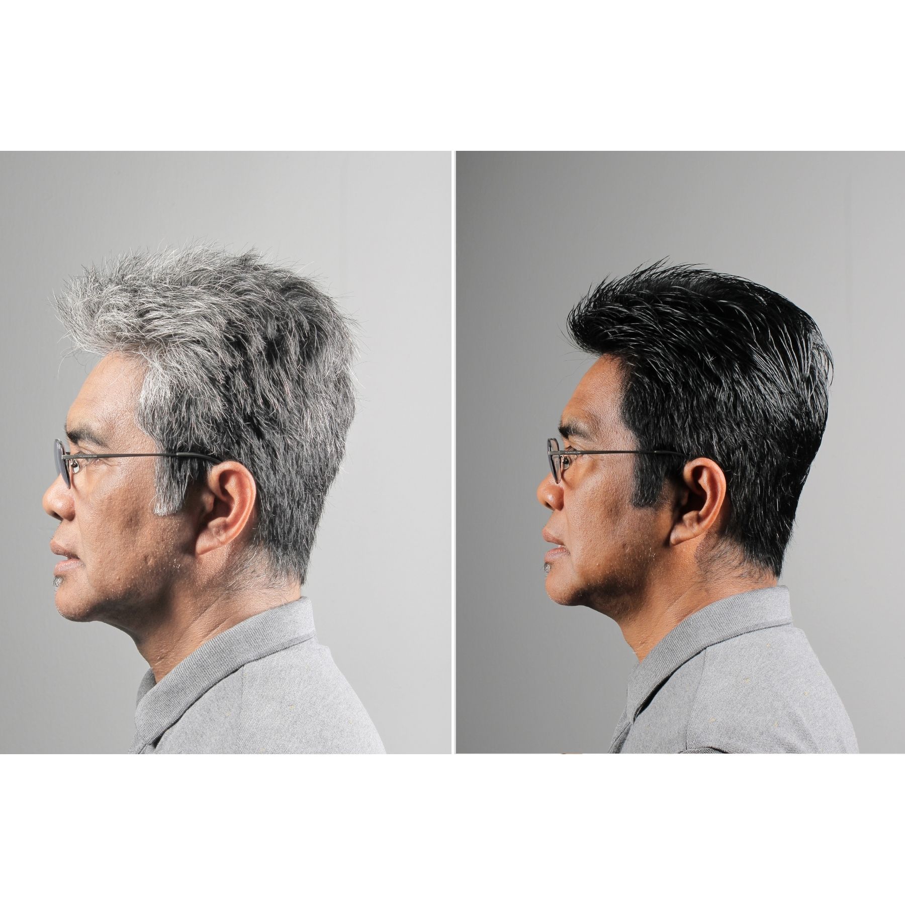 Mullia Before After 2